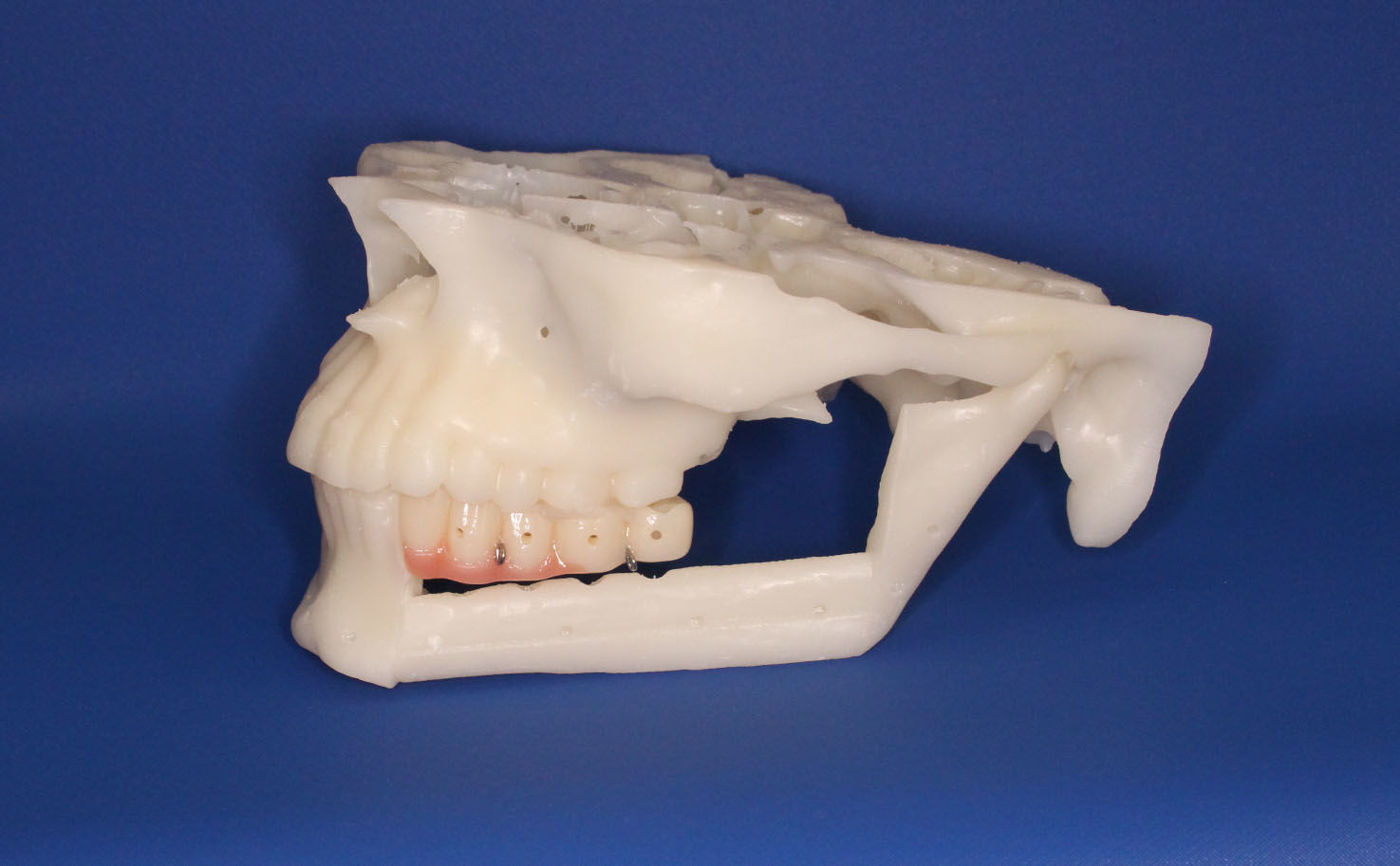 jaw guide